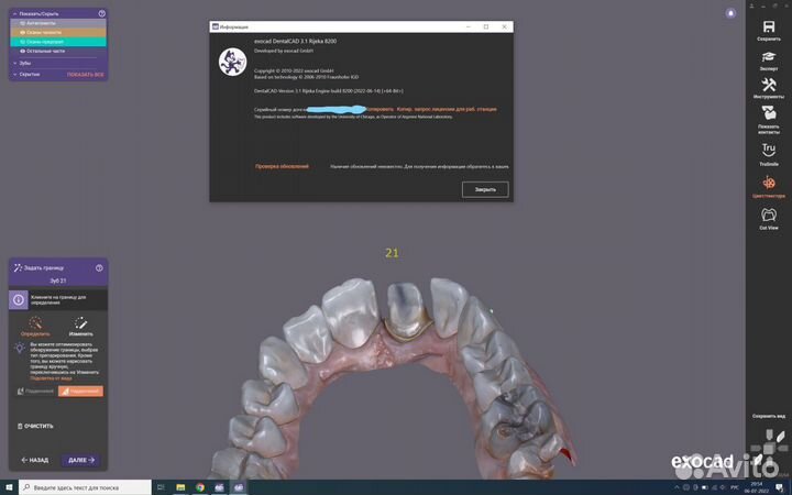 Exocad v.3.1 Rijeka bulld 8200