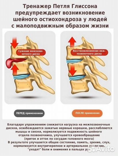 Петля Глиссона с креплением на дверь и турник
