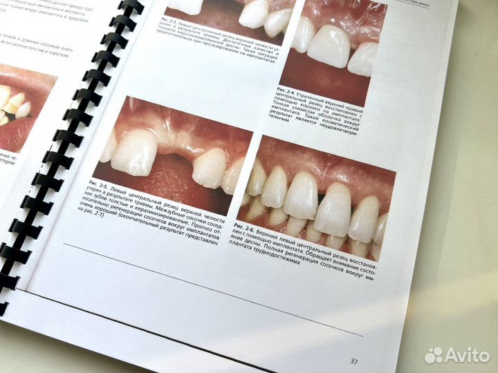 Факторы риска в стоматологической имплантологии