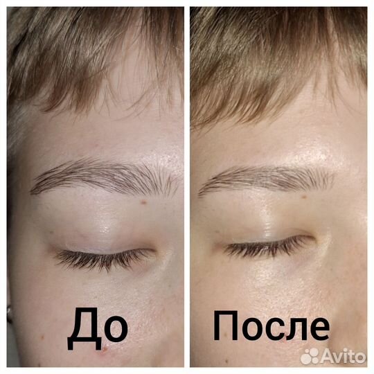 Бровист