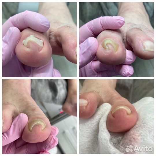 Услуги подолога