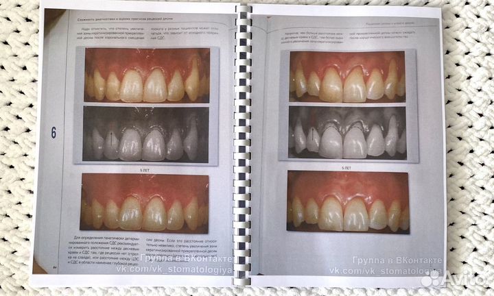 Пластическая хирургия мягких тканей полости рта