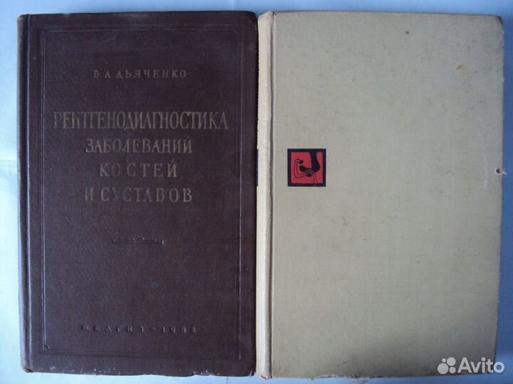 Рентгенодиагностика заболеваний костей и суставов