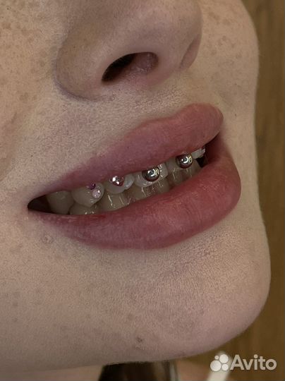 Установка скайсов