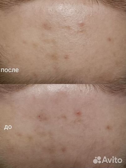 Услуги косметолога - эстетиста, массаж