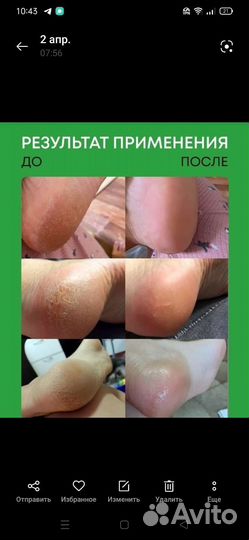 Средство для удаления ороговевшей кожи