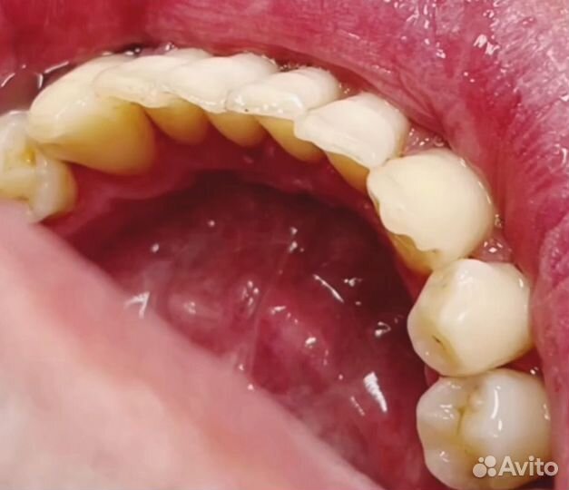 Профессиональная гигиена чистка сертификат