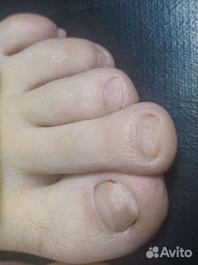 Педикюр классический на дому