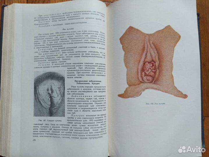 Гинекология.1957 Боляжина Жмакин Кватер Малиновски