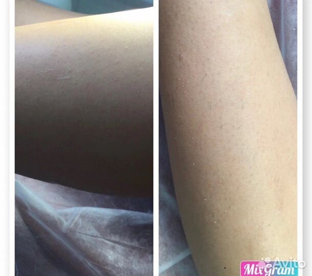 Мастер по шугарингу