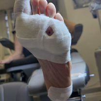 Подолог с медицинским образованием. Выезд на дом, Орёл