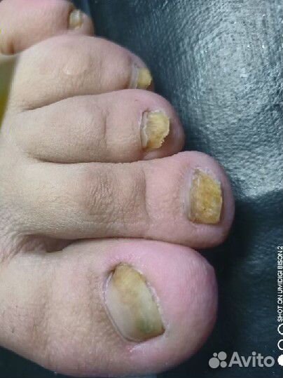 Педикюр классический на дому