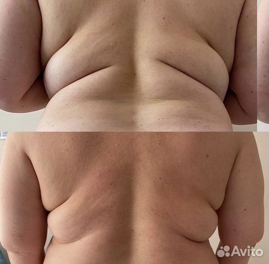 Массаж. Коррекция фигуры