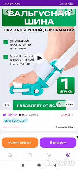 Вальгусная шина