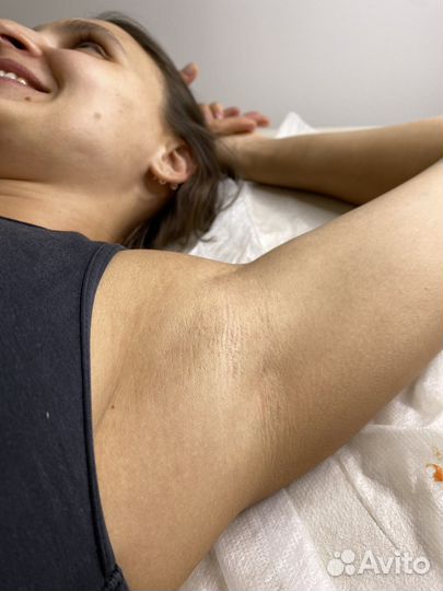 Шугаринг Депиляция Эпиляция женская и мужская