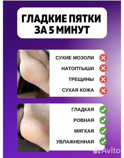 Гладкие пятоки