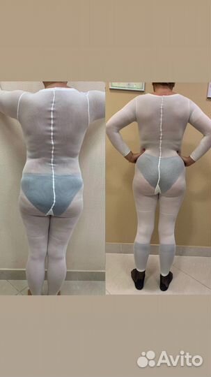 Массаж LPG лица и тела