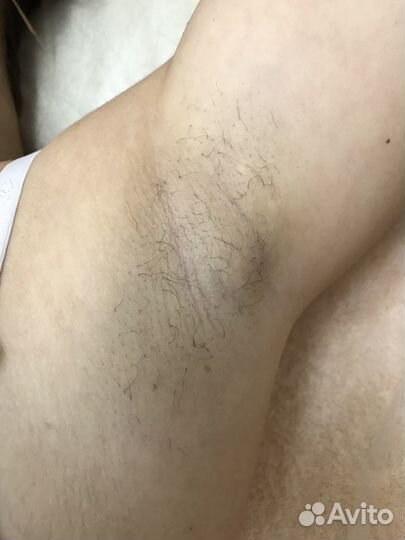 Шугаринг: глубокое бикини