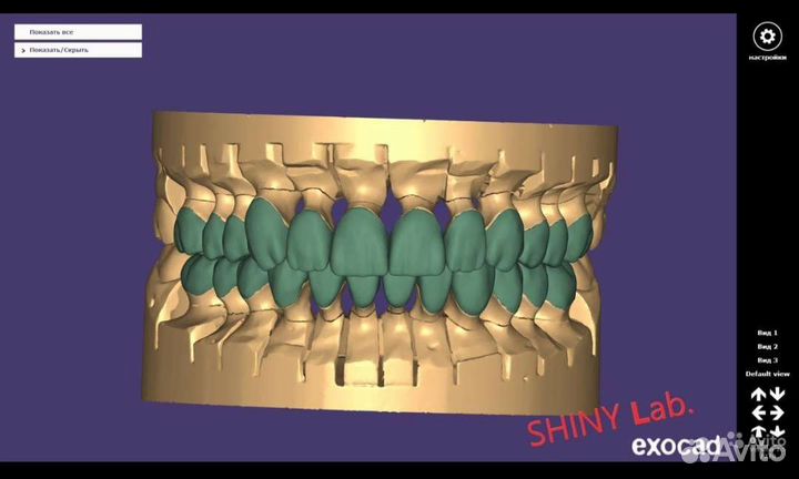 3d моделирование в exocad