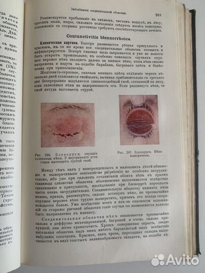 Антикварная книга. Руководство по глазным болезням