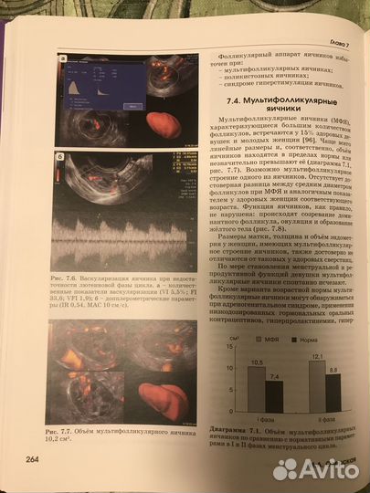 Эхография в гинекологии под ред. И.А. Озерская