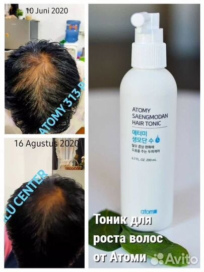 Спрей от выпадения Волос