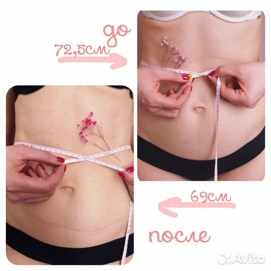 Скульптурирующий массаж