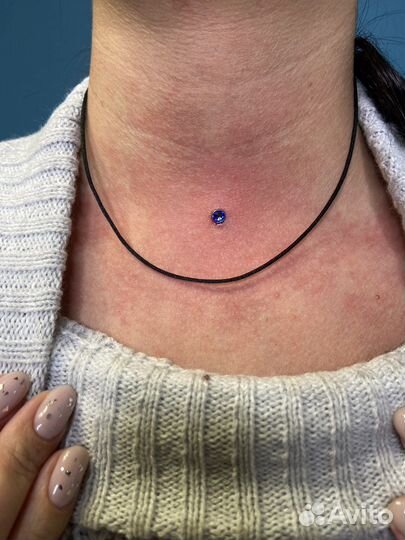 Модели на микродермалы