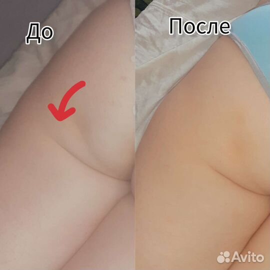 Массаж коррекция фигуры