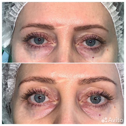 Холодная плазма + обучение