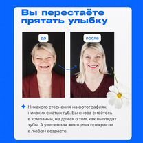Полная имплантация челюсти На 40+ лет Рассрочка, Москва