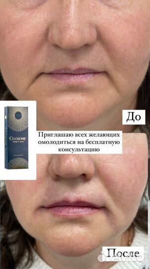 Косметология, лазерная эпиляция, трихопигментация