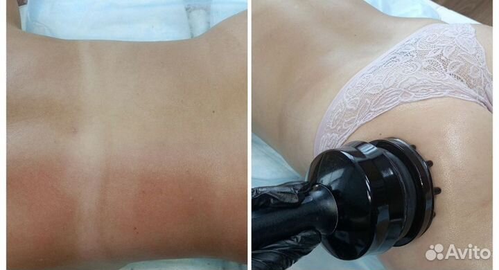 Вибромассаж.Прощай целлюлит