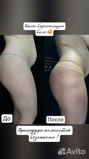 Моментальный загар с выездом