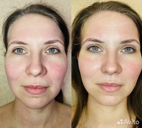 Массаж лица/микротоки/чистка лица