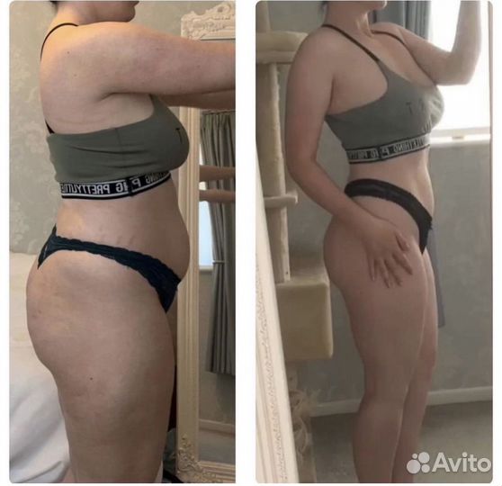 Супер Быстрое Сжигание Жира Криолиполиз 4D