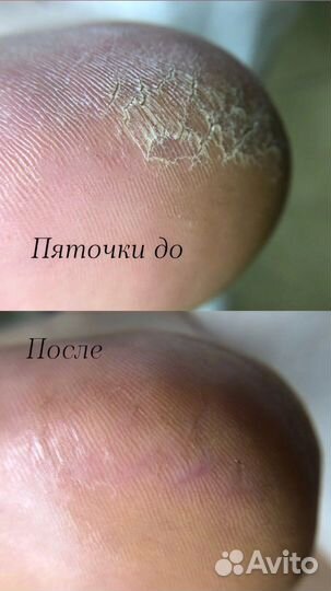 Педикюр/ Обработка стоп