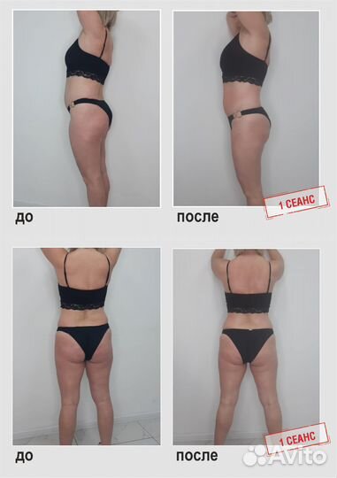 Массаж, коррекция фигуры