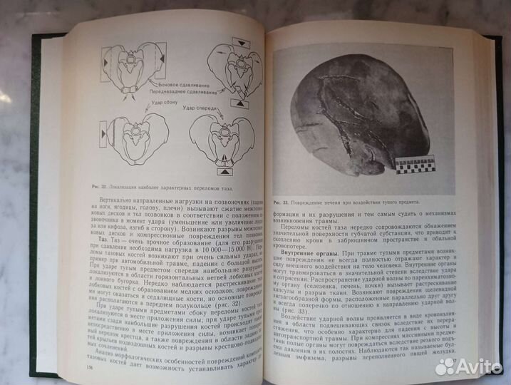 Судебная медицина Учебник Крюков В.Н