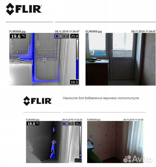 Обследование тепловизором