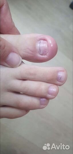 Педикюр. Подолог