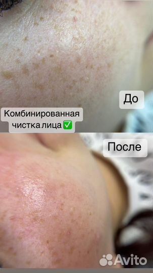 Косметолог эстетист