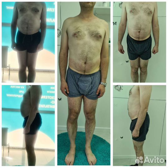 Коррекция фигуры