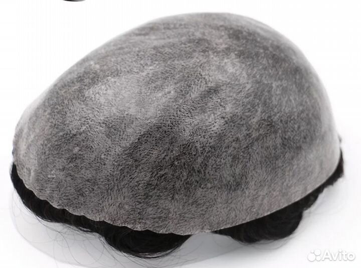 Система замещения волос для мужчин