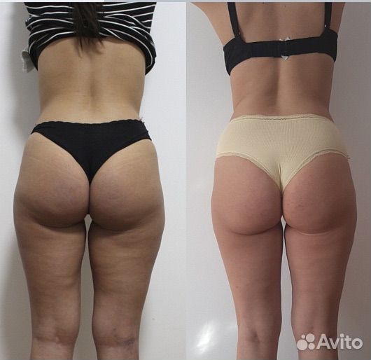 Массаж сферами