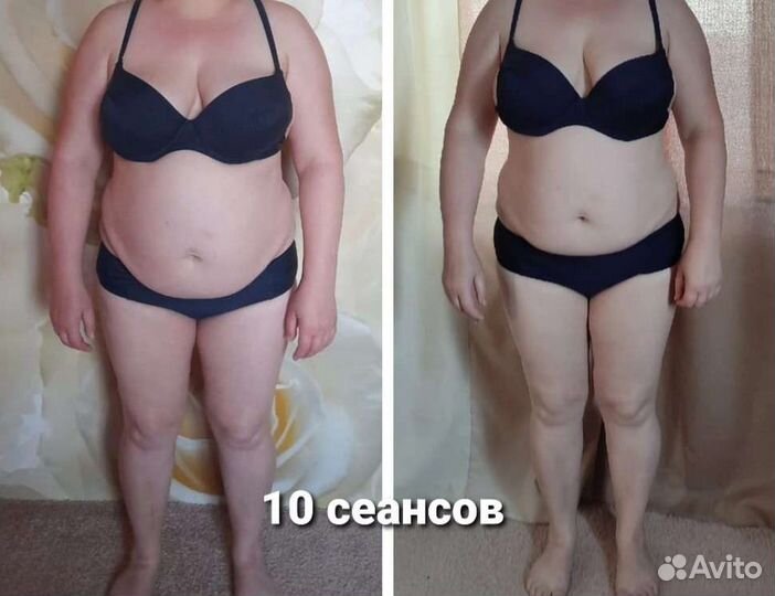 Быстрый эффект. Без боли