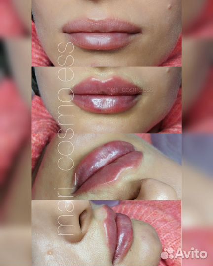 Косметология