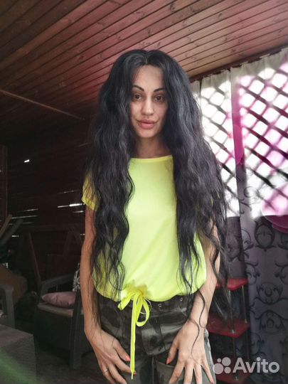 Система замещения волос