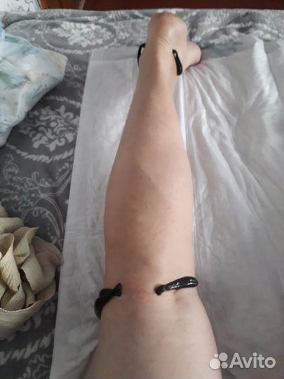 Пиявки гирудотерапия