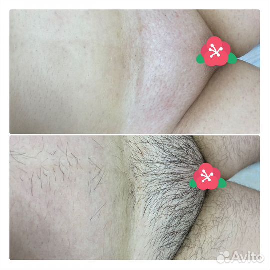 Шугаринг для мужчин и женщин /Ламинирование ресниц